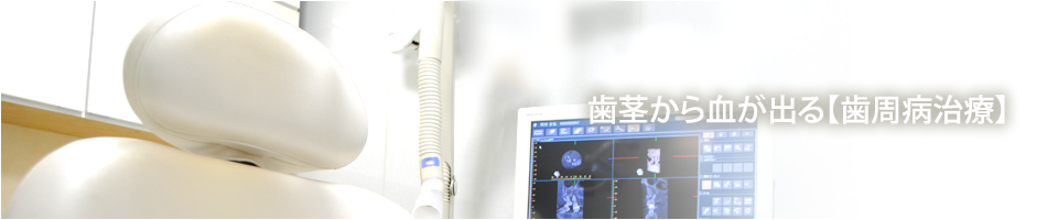 歯茎から血が出る【歯周病治療】