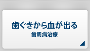 歯茎から血が出る【歯周病治療】